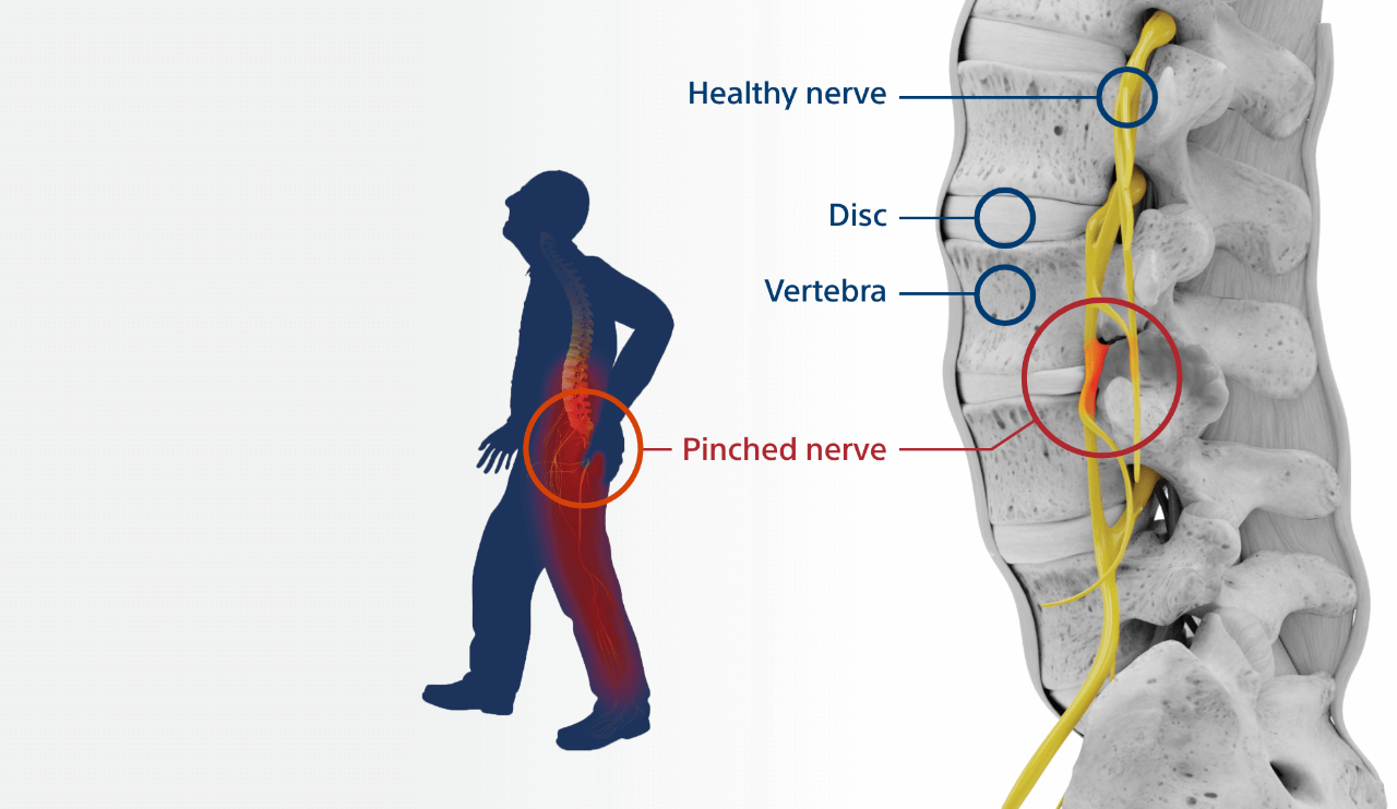 Silhouette of a man holding his lower back.